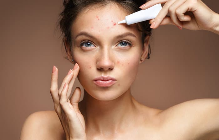 houston-Adult-Acne-Treatment